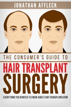 The Consumer's Guide to Hair Transplant Surgery