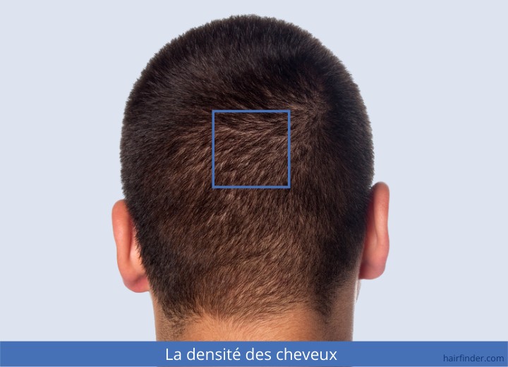 La densité des cheveux