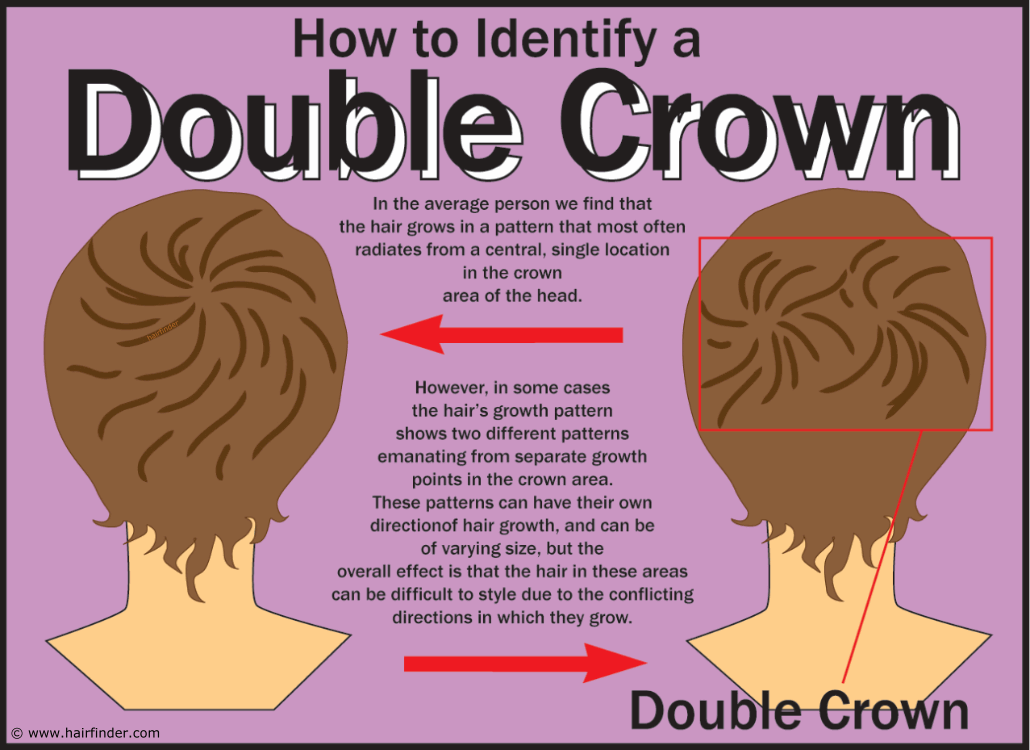 Double Crown in Hair  Hair Spruce